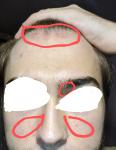 Почервоніння та лущення шкіри на обличчі фото 1