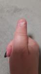 Возможно ли посиавить искусственную ногтевую пластину? фото 1