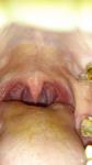 Проблемы полости рта фото 1