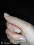 Пятно на ногте указательного пальца, не болит, фото 2