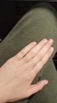 Что означает маленькая красная точка на пальце руки? фото 2