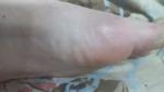 Болит палец левой ноги фото 3