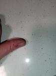 Отслаивание кожи на большом пальце левой руки фото 1