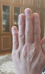 Почему увеличиваются суставы на пальцах рук? фото 2