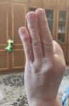 Почему увеличиваются суставы на пальцах рук? фото 1