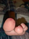 Красно-синин пятна на пальцах ног фото 2