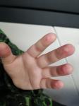 Красные пятна на пальцах у ребенка фото 1