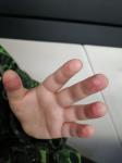 Красные пятна на пальцах у ребенка фото 2