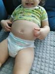 Надут живот у ребёнка после сальмонелеза фото 2
