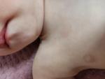 Сухие пятнышки на теле у ребенка 1.2 года фото 4