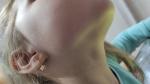 Сыпь у ребенка на груди и шее фото 2