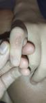 Дерматологическая проблема на пальце руки фото 2