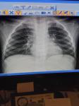 Сделайте описание лёгких ребенку фото 3