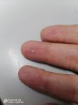 Белая точка на пальце фото 1