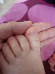 У ребенка ногти выгибаются фото 4