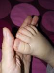 У ребенка ногти выгибаются фото 3