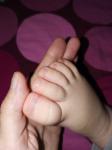 У ребенка ногти выгибаются фото 2