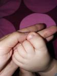 У ребенка ногти выгибаются фото 1