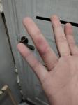 Беспричинный синяк в районе сустава пальца фото 1