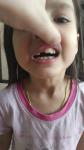 Кривые переднии зубы у ребенка фото 1