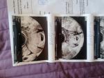 Нет сердцебиения у эмбриона фото 1