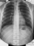 Кардиограмма и рентген у подростка етет фото 1