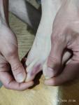 Гематома на пальце ноги после острой боли фото 1