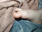 Опух палец на ноге у ребенка. Что делать? фото 1