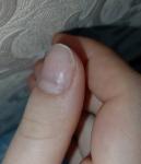 Проблема с ногтями после снятия фото 1