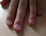 Плохие ногти фото 3
