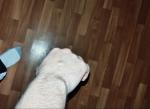 Вздувается часть вены на кисти фото 2