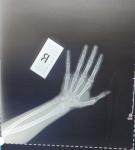 Зони росту фото 2