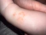 Шершавые пятна на ноге фото 2