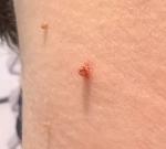 Странная черная родинка фото 4