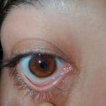 Как лечить это фото 1