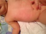 Мелкая красная сыпь у малыша в 8 месяцев фото 1