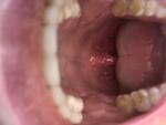 Сухой горловой кашель фото 3