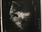 Не видно эмбриона фото 1