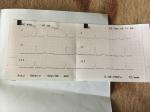 Изменения на ЭКГ после ОРВИ фото 1