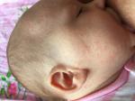 Аллергия на цветение у новорожденного фото 2