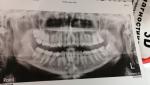 Почёму болит зуб фото 1
