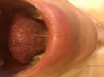 Стоматит и шишки под языком при беременности фото 1