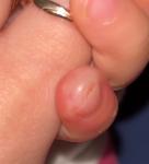 Красный палец фото 1