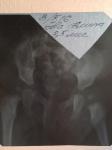 Дисплазия тазобедренного сустава, скошены углы фото 1