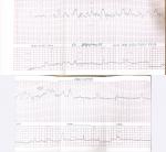 Ктг. Нет ли тахикардии? фото 1