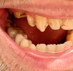 Вопрос гастроэнтерологу про зубы фото 1