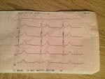Скажите пожалуйста кардиограмма в норме? фото 4