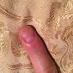 Проблема кожи и ногтей на руке фото 1