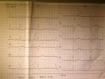 Не понятна ЭКГ. Жалоб нет, иногда бывает усталость фото 5