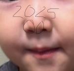 На носу появилось что-то мягкое фото 3